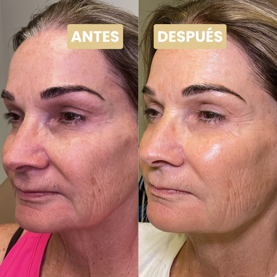 Velorie™ Sérum Natural Colágeno y Péptidos